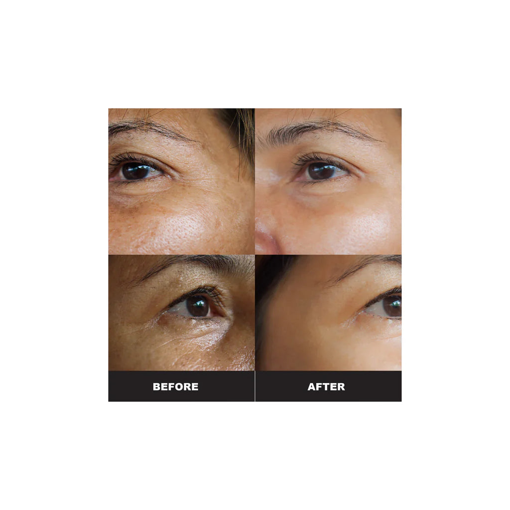 VIPTOX SERUM